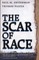 The Scar of Race