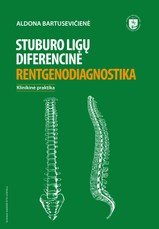 Stuburo ligų diferencinė rentgenodiagnostika
