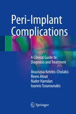 Peri-Implant Complications