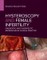 Hysteroscopy and Female Infertility