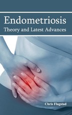 Endometriosis: Theory and Latest Advances