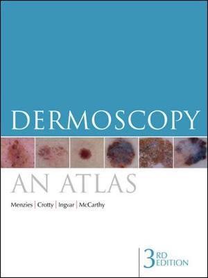 ダーモスコピーのすべて 第二版= TEXTBOOK OF DERMOSCOPY 81sJ5YLqXTL.jpg