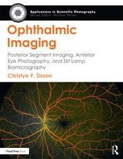 Ophthalmic Imaging