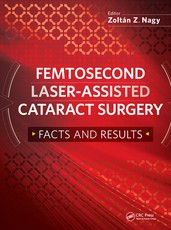 Femtosecond Laser-Assisted Cataract Surgery