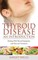 Thyroid Disease: An Introduction