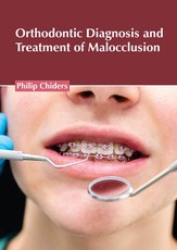 Orthodontic Diagnosis and Treatment of Malocclusion