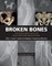 Broken Bones