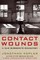 Contact Wounds