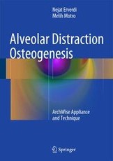 Alveolar Distraction Osteogenesis