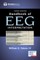 Handbook of Eeg Interpretation