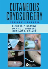 Usatine, R: Cutaneous Cryosurgery