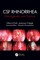 CSF Rhinorrhoea