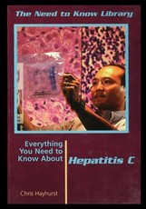 Hepatitis C