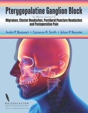 Pterygopalatine Ganglion Block