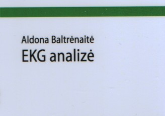 EKG analizė