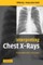 Interpreting Chest X-Rays