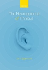 The Neuroscience of Tinnitus