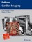 Cardiac Imaging