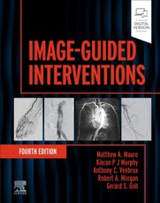 Image-Guided Interventions