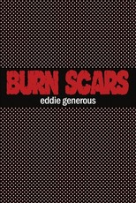 Burn Scars