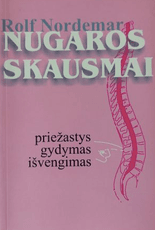 Nugaros skausmai. Priežastys, gydymas ir išvengimas