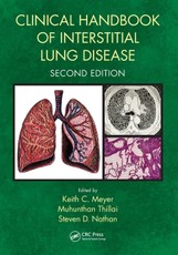 Clinical Handbook of Interstitial Lung Disease