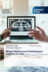 Mixed Radiolucent Radiopaque Lesions of Jaw