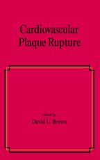 Cardiovascular Plaque Rupture