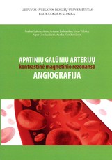 Apatinių galūnių arterijų kontrastinė magnetinio rezonanso angiografija