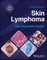 Skin Lymphoma