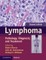 Lymphoma