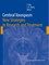 Cerebral Vasospasm