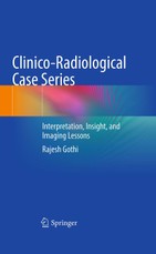 Clinico-Radiological Case Series