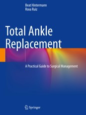 Total Ankle Replacement