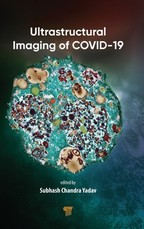 Ultrastructural Imaging of Covid-19