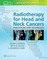 Radiotherapy for Head and Neck Cancers