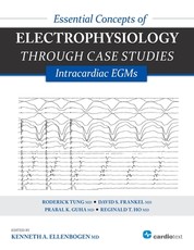Essential Concepts of Electrophysiology through Case Studies
