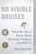 No Visible Bruises