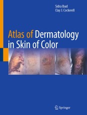 Atlas of Dermatology in Skin of Color