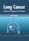 Lung Cancer: Advances in Diagnosis and Treatment