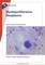 Fast Facts: Myeloproliferative Neoplasms