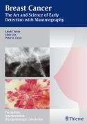 Tabar, L: Breast Cancer - The Art and Science of Early Detec