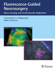 Fluorescence-Guided Neurosurgery