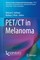 PET/CT in Melanoma