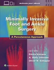 Minimally Invasive Surgery in Foot and Ankle: A Percutaneous Approach