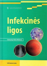 Infekcinės ligos