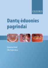 Dantų ėduonies pagrindai