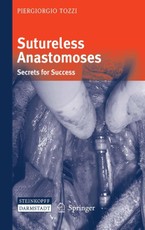 Sutureless Anastomoses