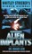 Casebook: Alien Implants