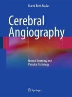 Cerebral Angiography